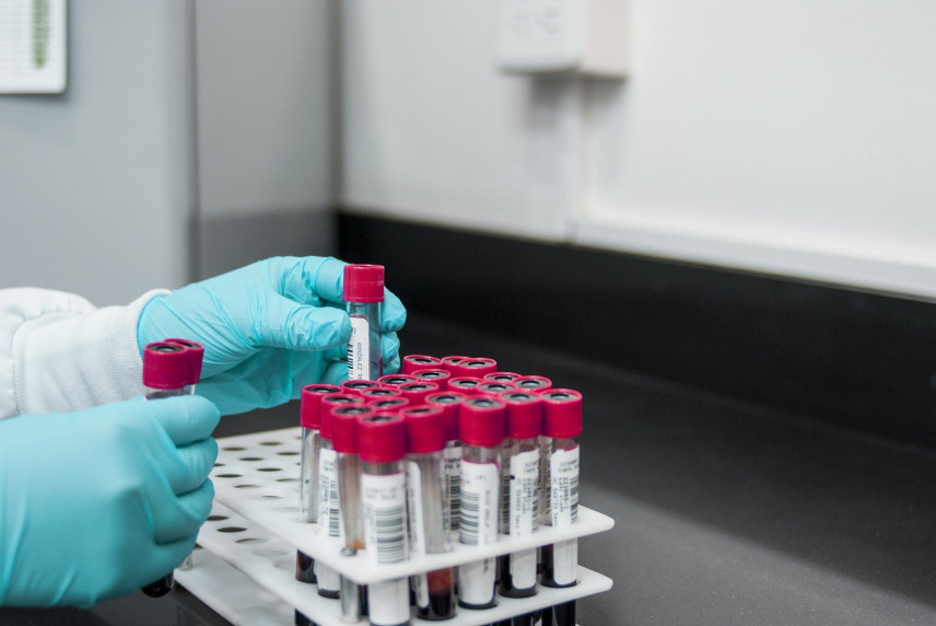 В Чехии ввели обязательный тест на коронавирус для чиновников